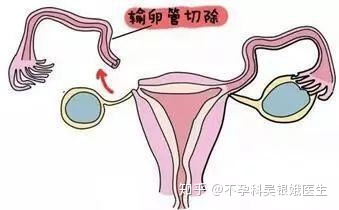 供卵试管婴儿费用推荐和万家-供卵试管婴儿费用1万多