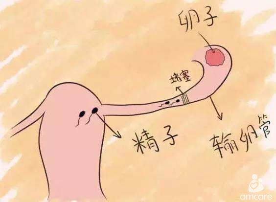 镇江第三代供卵试管婴儿，40岁生儿子的梦想，你怎么看？